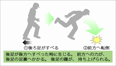 転倒災害・すべりによる前方・側方への転倒